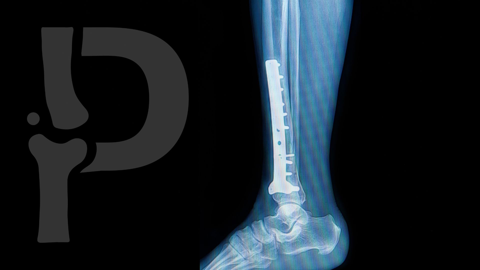 Sin título 1920 x 1080 px 30